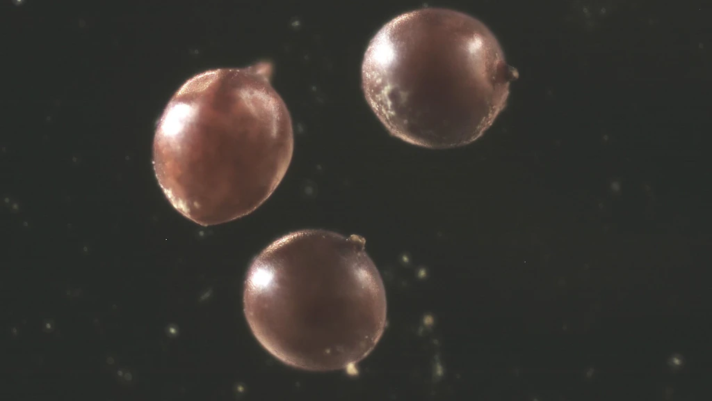 Zysten von Globodera pallida