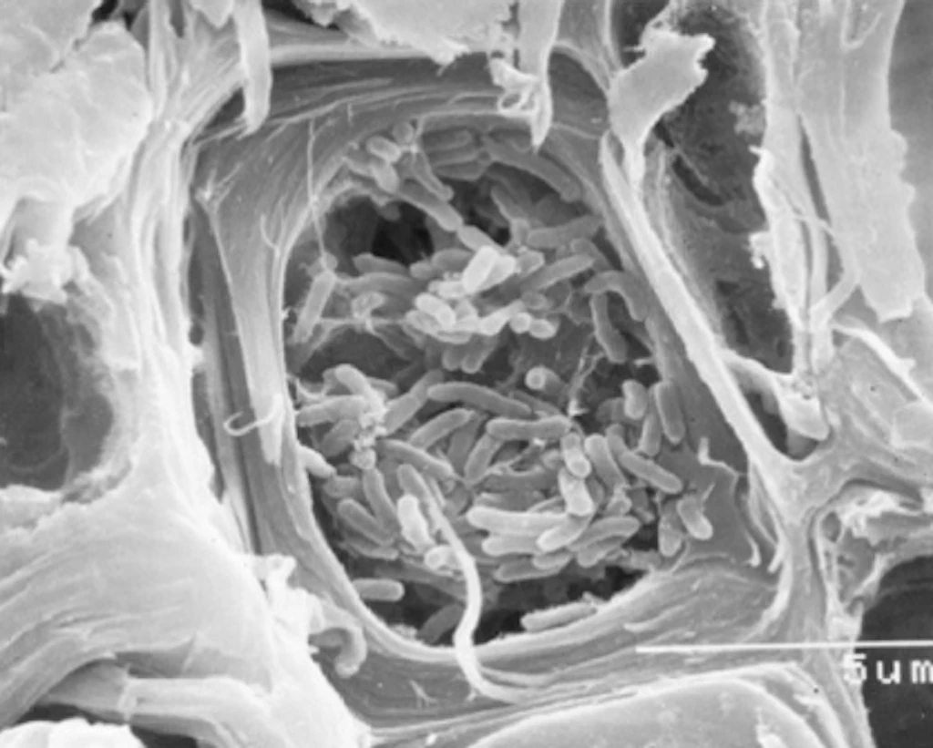 Elektronenmikroskopische Aufnahme von Xylella fastidiosa in einem Xylemgefäss des Blattstiels eines Kaffeeblatts
