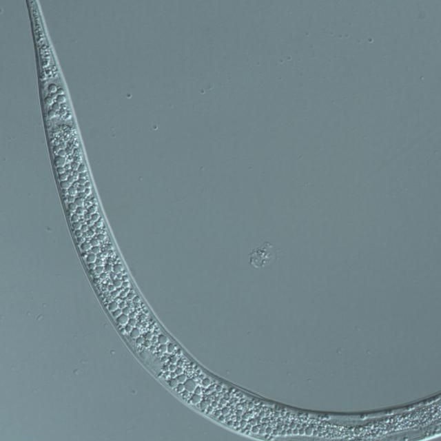 M. enterolobii sous le microscope